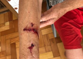 IDOSA É ATACADA POR CACHORRO ENQUANTO FAZIA SUA CAMINHADA EM NOVA ROMA DO SUL