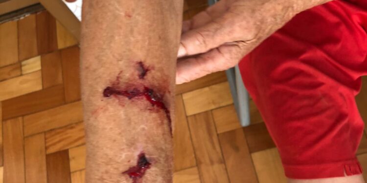 IDOSA É ATACADA POR CACHORRO ENQUANTO FAZIA SUA CAMINHADA EM NOVA ROMA DO SUL