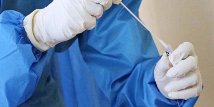 Boletim desta quarta-feira registra 12 casos ativos de Covid-19 em Antônio Prado