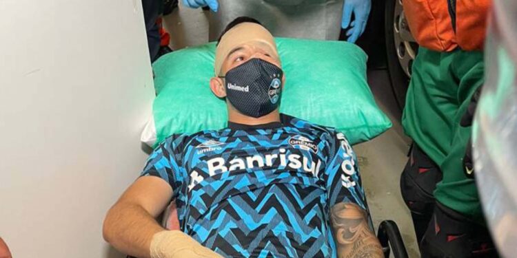 Após ataque a ônibus, Villasanti sofre traumatismo craniano e concussão cerebral