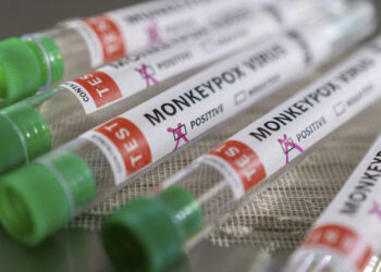 Uruguaiana confirma primeiro caso de varíola do macaco