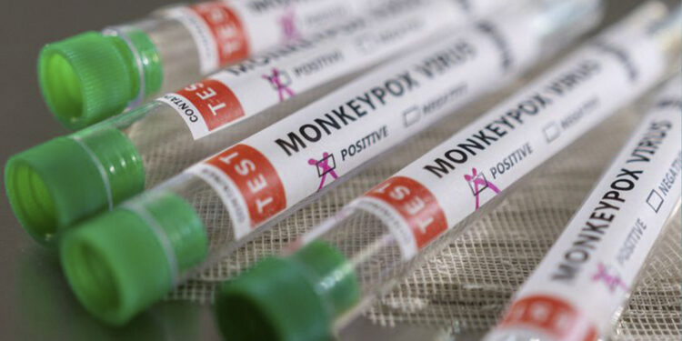 Uruguaiana confirma primeiro caso de varíola do macaco