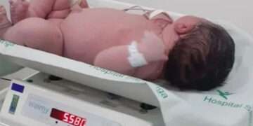 Bebê ‘gigante’ nasce com 5,5kg, no Hospital de Sapiranga no RS