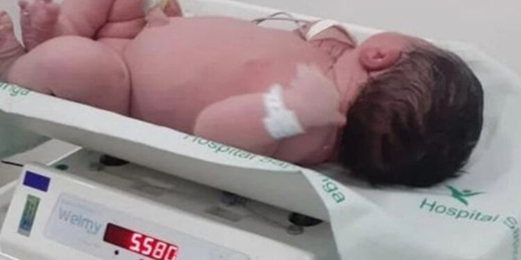 Bebê ‘gigante’ nasce com 5,5kg, no Hospital de Sapiranga no RS