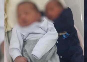 Caso raro: Jovem de Goiás dá à luz gêmeos de pais diferentes