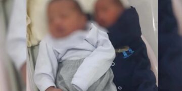 Caso raro: Jovem de Goiás dá à luz gêmeos de pais diferentes
