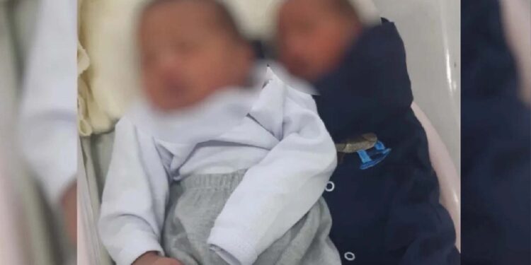 Caso raro: Jovem de Goiás dá à luz gêmeos de pais diferentes