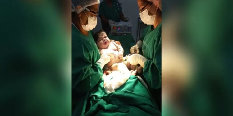 Mãe dá à luz a bebê com mais de 7 quilos no Amazonas