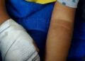 Bebê tem dedo amputado durante retirada de atadura em hospital no Rio de Janeiro