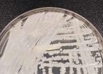 São Paulo confirma primeiro caso de superfungo Candida auris