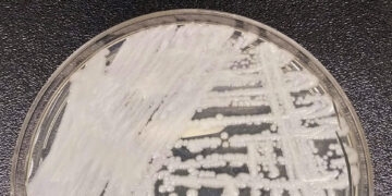 São Paulo confirma primeiro caso de superfungo Candida auris