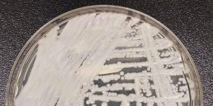 São Paulo confirma primeiro caso de superfungo Candida auris