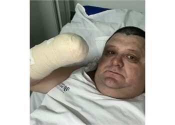 Humorista Pilha perde a mão após estourar foguete no Oeste de SC