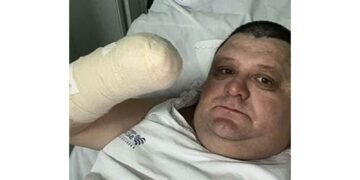 Humorista Pilha perde a mão após estourar foguete no Oeste de SC