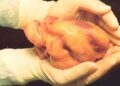 Conheça o único país que permite a venda de órgãos humanos