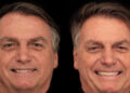 Bolsonaro gasta mais de R$ 80 mil em harmonização facial e dentária