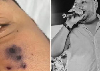 Cantor de forró morre após ser picado por aranha