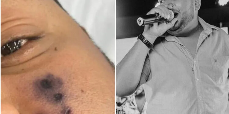 Cantor de forró morre após ser picado por aranha