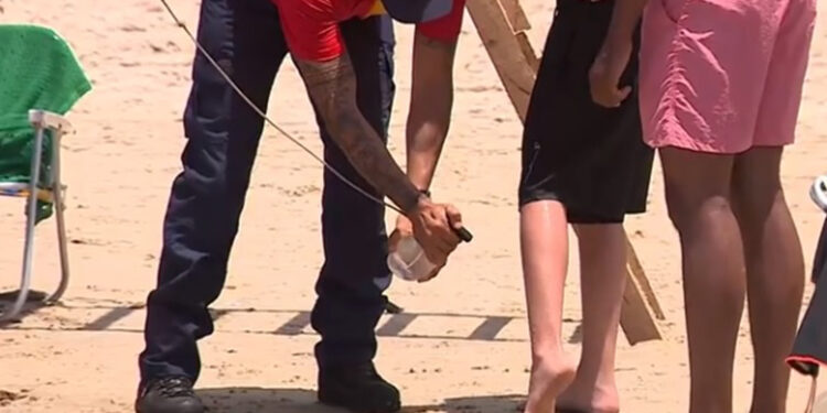 Queimaduras por água-viva aumentam mais de 700% no litoral do RS; saiba como se proteger