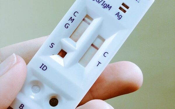 Saúde passa a recomendar testes rápidos para diagnóstico de dengue