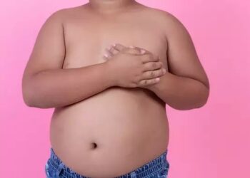 Crianças brasileiras estão mais altas e mais obesas