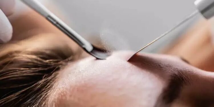 nvisa proíbe temporariamente venda e uso de produtos à base de fenol