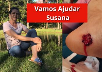 Vamos Ajudar Susana: Cada Contribuição Faz a Diferença!