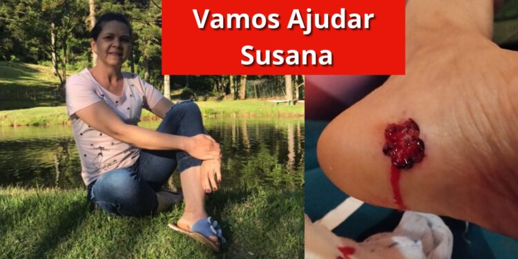 Vamos Ajudar Susana: Cada Contribuição Faz a Diferença!