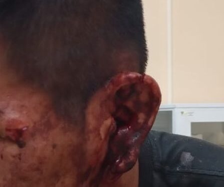 Homem é esfaqueado na orelha e no rosto em Briga na Linha Salete Interior de Nova Roma Do Sul