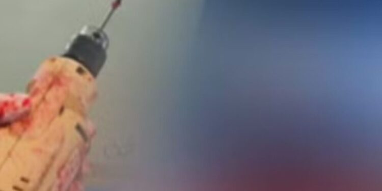 Hospital é acusado de esconder furadeiras domésticas usadas em cirurgias durante fiscalização