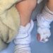 Bebê de 11 meses tem queimaduras de 2º grau após banho em escola no RS